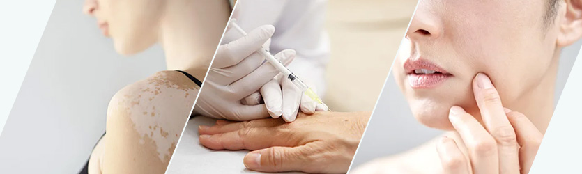 美容医療コラム