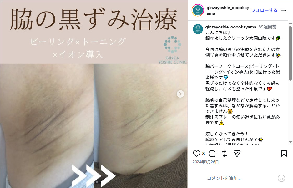 銀座よしえクリニックインスタグラム
