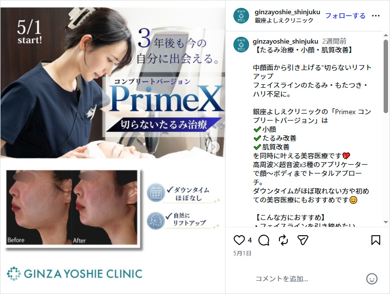 銀座よしえクリニックインスタグラム