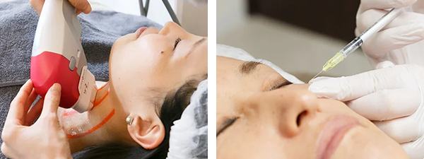 医療ハイフフェイスラインリフト3D(頬＋顎下＋首)＋高持続型純正ヒアルロン酸注入