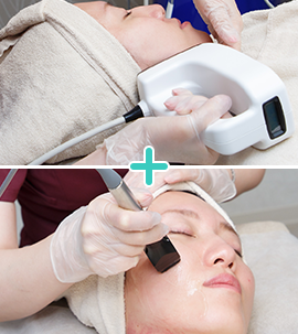 インモードVリフト(miniFX+FORMA)