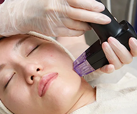 モフィウス8（頬～顎下）