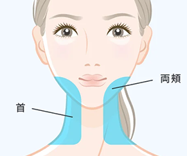 ボトックスリフト