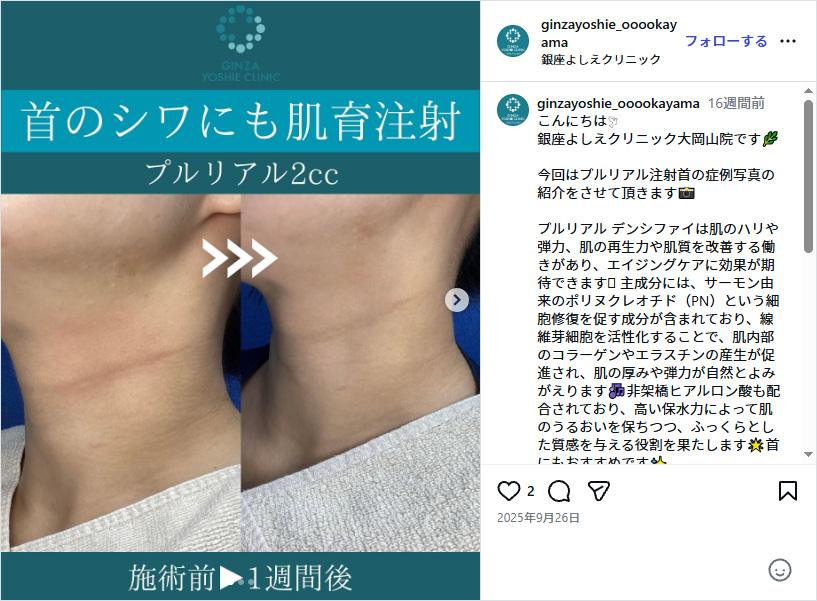 インスタグラム