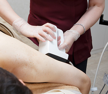 インモードボディFX(Body FX)