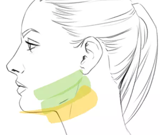 ミニFX(mini FX)の照射エリア