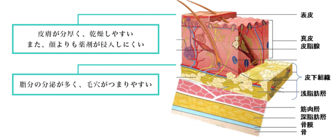 背中や肩や二の腕、デコルテ(胸)のにきびの原因