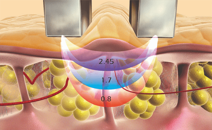 ReFit(リフィット)/ReLift(リリフト)