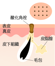 毛穴の黒ずみ