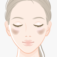 肝斑(かんぱん)