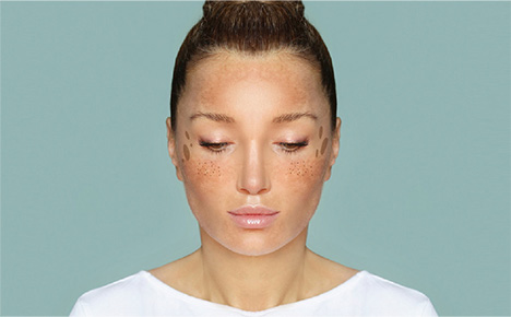 私のシミはどれかな?