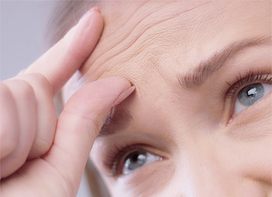眉間のシワ、おでこのシワ、目尻のシワ治療