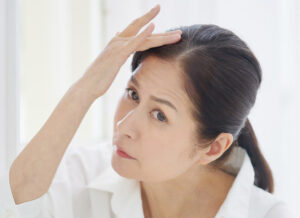 内服治療(女性)