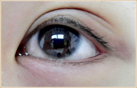 アートメイク　アイライン 治療前