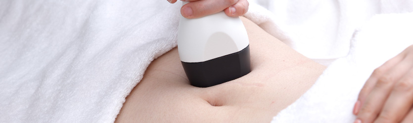 肉割れ（ストレッチマーク）・妊娠線の治療