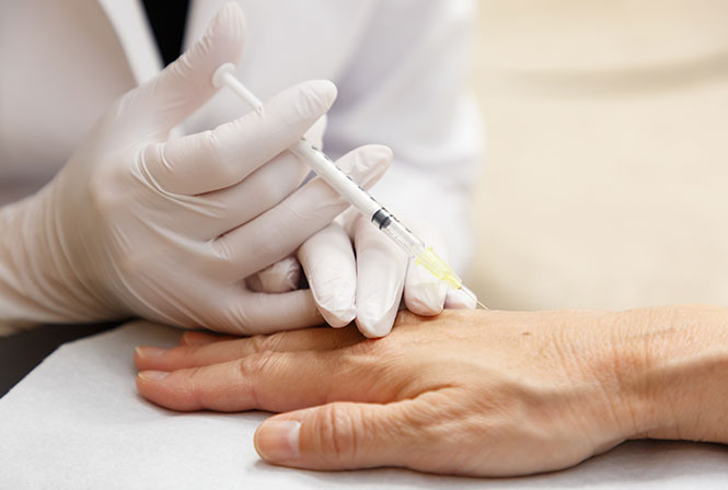 気になる手のシワの改善ポイント。手の甲のしわをなくす方法とは