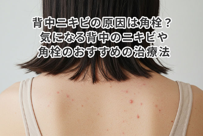 背中ニキビの原因は角栓? 気になる背中のニキビや角栓のおすすめの治療法