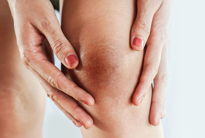 膝の黒ずみを消したい。黒ずみの原因は？セルフケアや治療法は？　