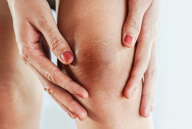 ひざ(膝)の黒ずみ