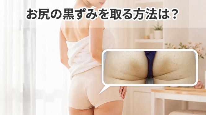 お尻の黒ずみを取る方法は？セルフケアから市販クリーム、美容医療まで解説