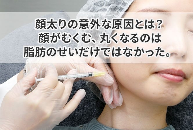 顔太りの意外な原因とは？顔がむくむ、丸くなるのは脂肪のせいだけではなかった。