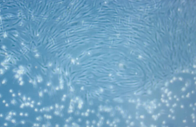 線維芽細胞を増やすことはできる？その方法を医師が解説します