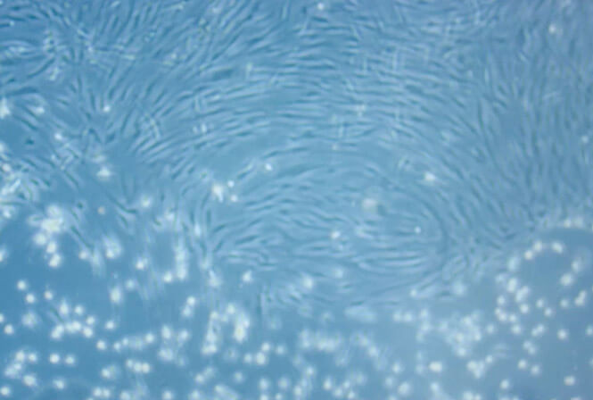 線維芽細胞を増やすことはできる？その方法を医師が解説します