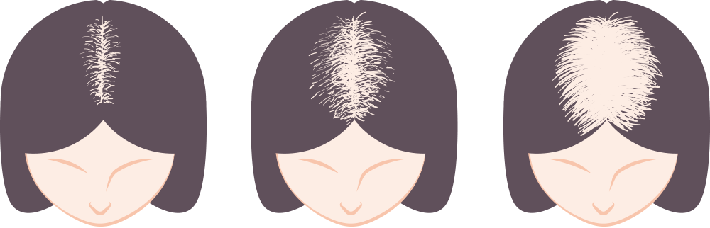 ルードヴィッヒ分類