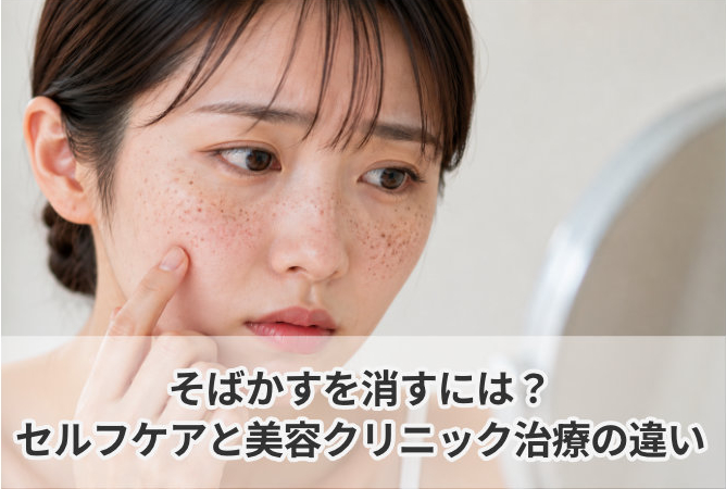 そばかすを消すには？セルフケアと美容クリニック治療の違い