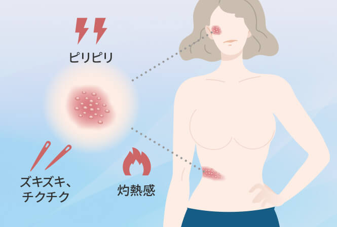 痛みが長引く帯状疱疹後神経痛（PHN）と有効な治療とは？