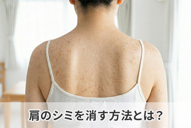肩のシミを消す方法とは？知らないと悪化する6つの原因