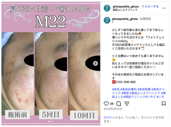 銀座よしえクリニックインスタグラム