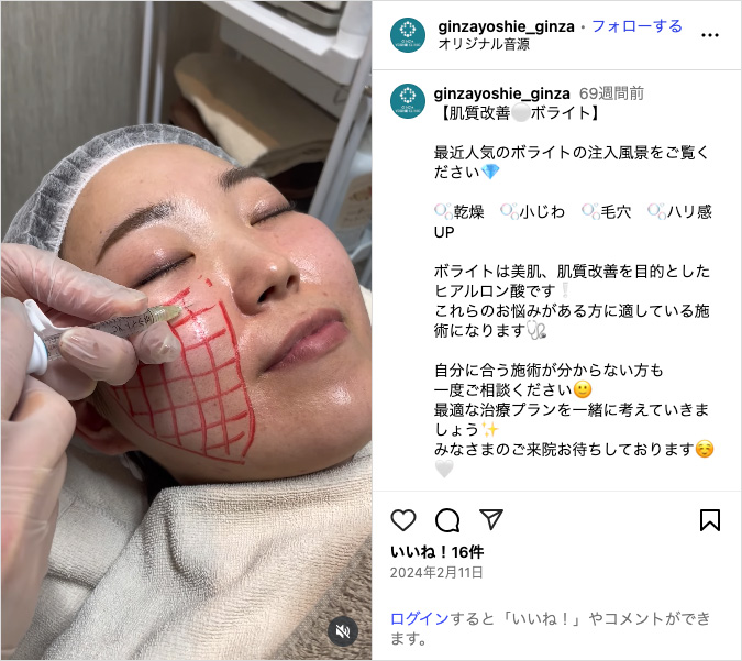 インスタグラム