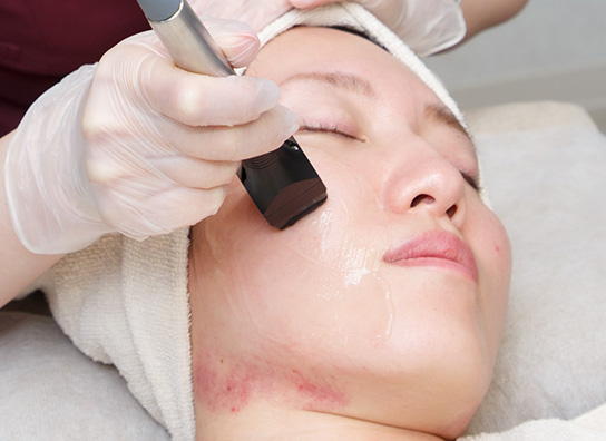 おすすめの治療方法：インモードVリフト（インモードリフティング）