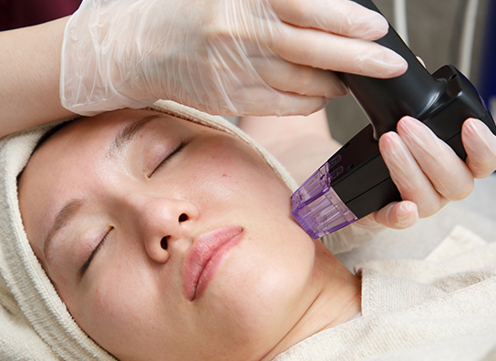 モフィウス8（マイクロニードルRF）