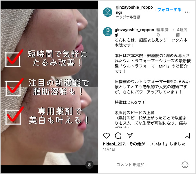 銀座よしえクリニックインスタグラム